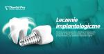 Leczenie implantologiczne w Dental-Pro Gdynia Pogórze